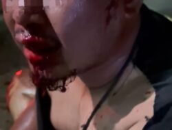Alat Ruyung Disebut Muncul di Pengeroyokan Tanggulangin, Korban Luka Berat Desak Polisi Gerak Cepat