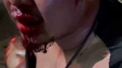 Alat Ruyung Disebut Muncul di Pengeroyokan Tanggulangin, Korban Luka Berat Desak Polisi Gerak Cepat